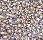 AMACR Antibody in Immunohistochemistry (Paraffin) (IHC (P))