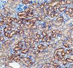 AMACR Antibody in Immunohistochemistry (Paraffin) (IHC (P))
