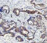 AMACR Antibody in Immunohistochemistry (Paraffin) (IHC (P))