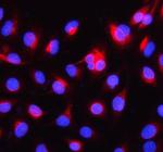 alpha Internexin Polyclonal Antibody