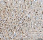 alpha Internexin Antibody in Immunohistochemistry (Paraffin) (IHC (P))