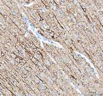 alpha Internexin Antibody in Immunohistochemistry (Paraffin) (IHC (P))