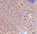 alpha Internexin Antibody in Immunohistochemistry (Paraffin) (IHC (P))