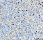 alpha Internexin Antibody in Immunohistochemistry (Paraffin) (IHC (P))