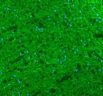 alpha Internexin Antibody in Immunohistochemistry (Paraffin) (IHC (P))