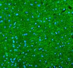 alpha Internexin Antibody in Immunohistochemistry (Paraffin) (IHC (P))