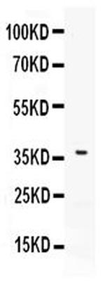 CD273 (B7-DC) Antibody in Western Blot (WB)