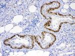 ACVR2A Antibody in Immunohistochemistry (Paraffin) (IHC (P))