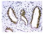 KDM5B Antibody in Immunohistochemistry (Paraffin) (IHC (P))