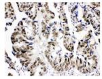 KDM5B Antibody in Immunohistochemistry (Paraffin) (IHC (P))