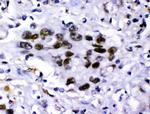 KDM5B Antibody in Immunohistochemistry (Paraffin) (IHC (P))