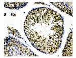 KDM5B Antibody in Immunohistochemistry (Paraffin) (IHC (P))