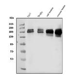 KDM5B Antibody in Western Blot (WB)