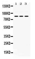 KRIT1 Antibody in Western Blot (WB)
