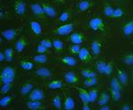RPSA Polyclonal Antibody