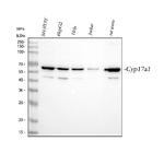 CYP17A1 Antibody in Western Blot (WB)