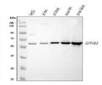 EPHX2 Polyclonal Antibody