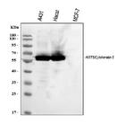 Cytokeratin 5 Antibody in Western Blot (WB)