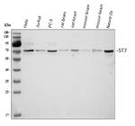 ST7 Antibody in Western Blot (WB)