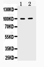 TACC1 Polyclonal Antibody