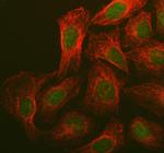 BRCA1 Polyclonal Antibody