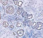 Cytokeratin 18 Antibody in Immunohistochemistry (Paraffin) (IHC (P))