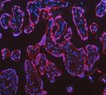 Cytokeratin 18 Antibody in Immunohistochemistry (Paraffin) (IHC (P))
