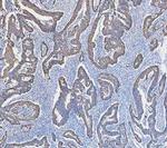 Cytokeratin 18 Antibody in Immunohistochemistry (Paraffin) (IHC (P))