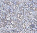 Cytokeratin 18 Antibody in Immunohistochemistry (Paraffin) (IHC (P))