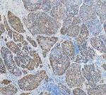 Cytokeratin 18 Antibody in Immunohistochemistry (Paraffin) (IHC (P))