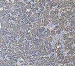 Cytokeratin 18 Antibody in Immunohistochemistry (Paraffin) (IHC (P))