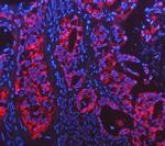 Cytokeratin 18 Antibody in Immunohistochemistry (Paraffin) (IHC (P))