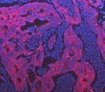 Cytokeratin 18 Antibody in Immunohistochemistry (Paraffin) (IHC (P))