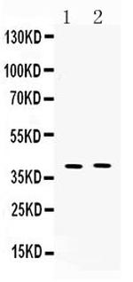 MC3R Polyclonal Antibody