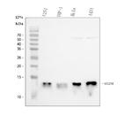 beta-2 Microglobulin Antibody in Western Blot (WB)