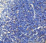 Survivin Antibody in Immunohistochemistry (Paraffin) (IHC (P))