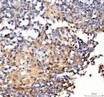 Survivin Polyclonal Antibody