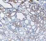 Cytokeratin 8 Antibody in Immunohistochemistry (Paraffin) (IHC (P))