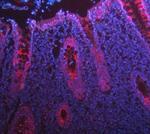 Cytokeratin 8 Antibody in Immunohistochemistry (Paraffin) (IHC (P))