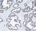 Cytokeratin 8 Antibody in Immunohistochemistry (Paraffin) (IHC (P))