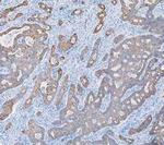 Cytokeratin 8 Antibody in Immunohistochemistry (Paraffin) (IHC (P))