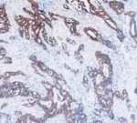 Cytokeratin 8 Antibody in Immunohistochemistry (Paraffin) (IHC (P))