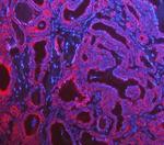 Cytokeratin 8 Polyclonal Antibody