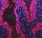 Cytokeratin 8 Antibody in Immunohistochemistry (Paraffin) (IHC (P))