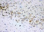 S6 Antibody in Immunohistochemistry (Paraffin) (IHC (P))