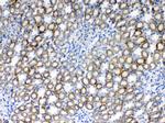 S6 Antibody in Immunohistochemistry (Paraffin) (IHC (P))