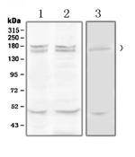 Thrombospondin 1 Polyclonal Antibody