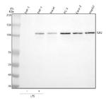 TLR2 Antibody in Western Blot (WB)