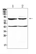 TSH Receptor Polyclonal Antibody