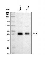 ATOH1 Polyclonal Antibody